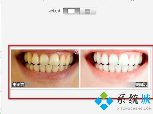 美圖秀秀怎么美白牙齒 美圖秀秀局部美白教程