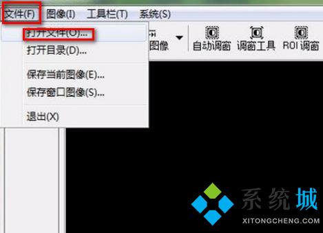 dcm文件怎么打開(kāi) dcm文件用什么軟件打開(kāi)